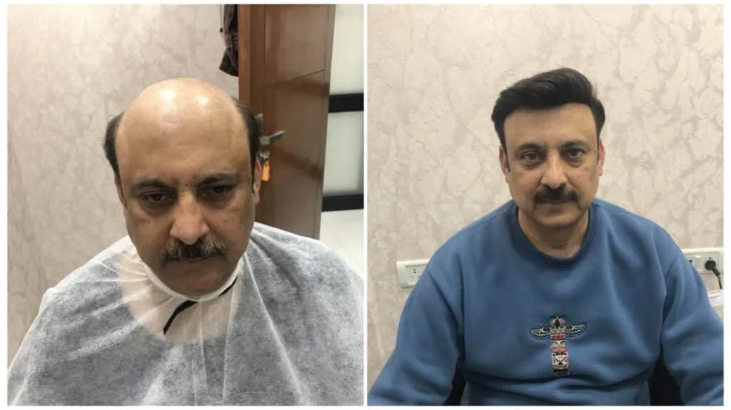 Hair fixing consultation